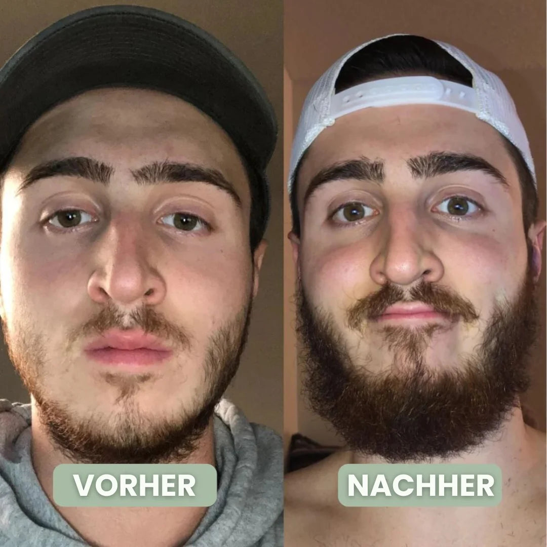 BeardPrime™ – Bartwuchsserum