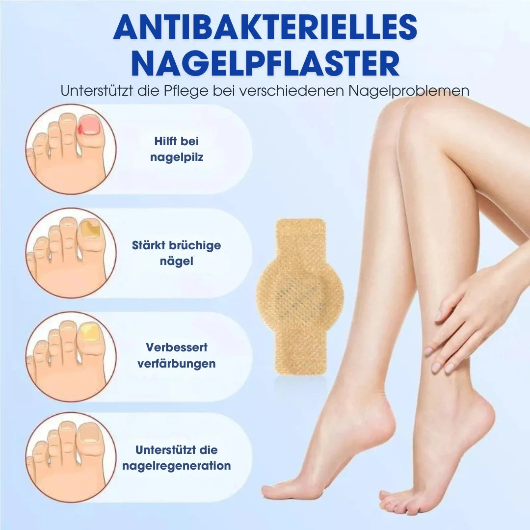 FUNGEX™ – Nagelpflaster gegen Nagelpilz